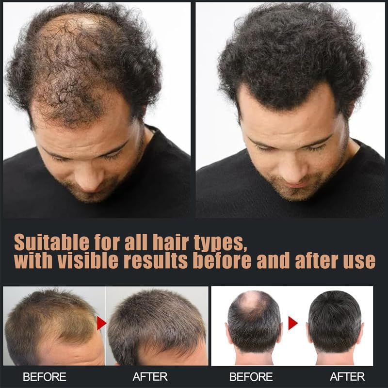Spatan Root Activator Shampoo, Spatan Hair Growth Shampoo for Men & Women, Natural Formula for Thicker, Stronger, and Healthier Hair - Nourishing Repairing Hair Loss & Scalp Health