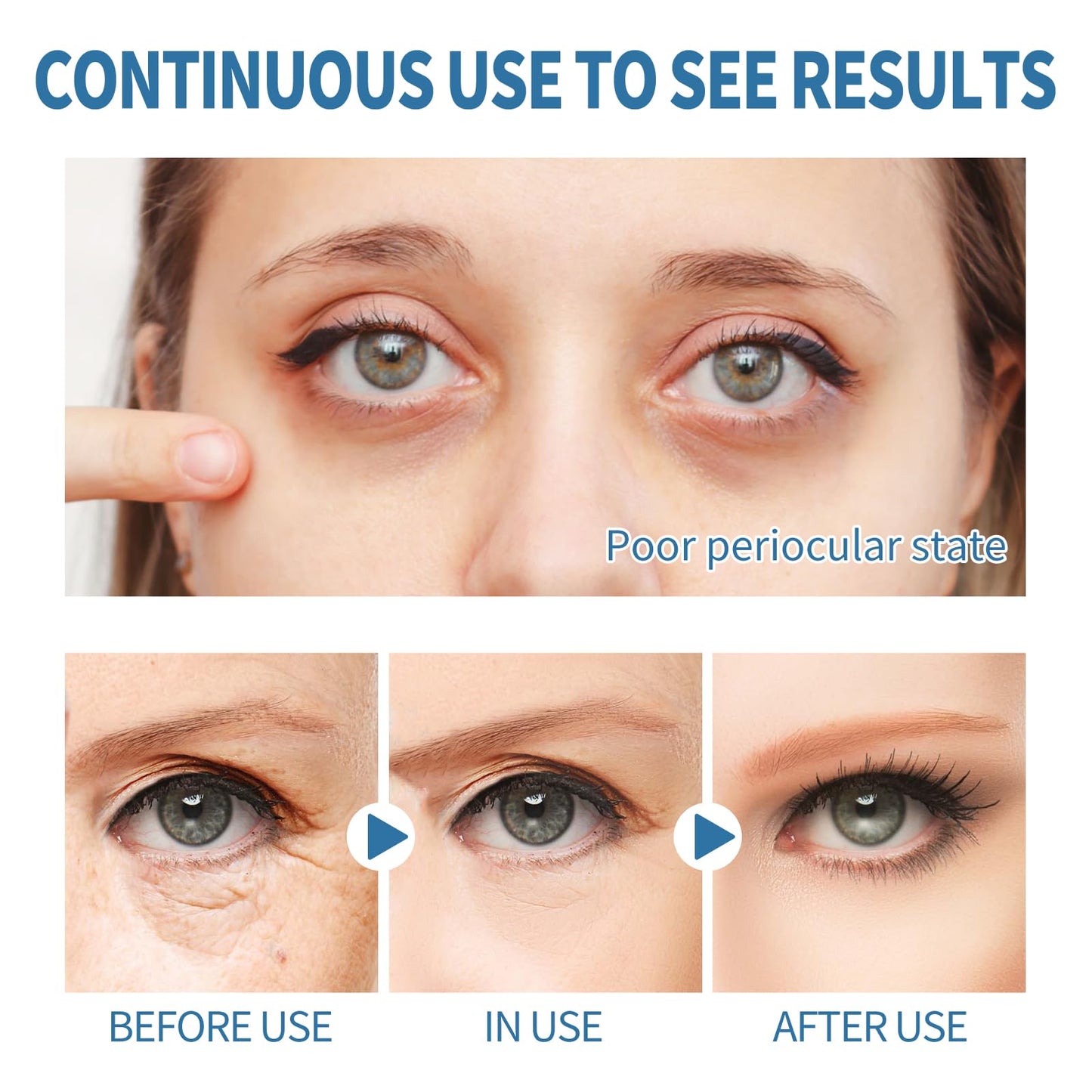EELHOE Under Eye Patches