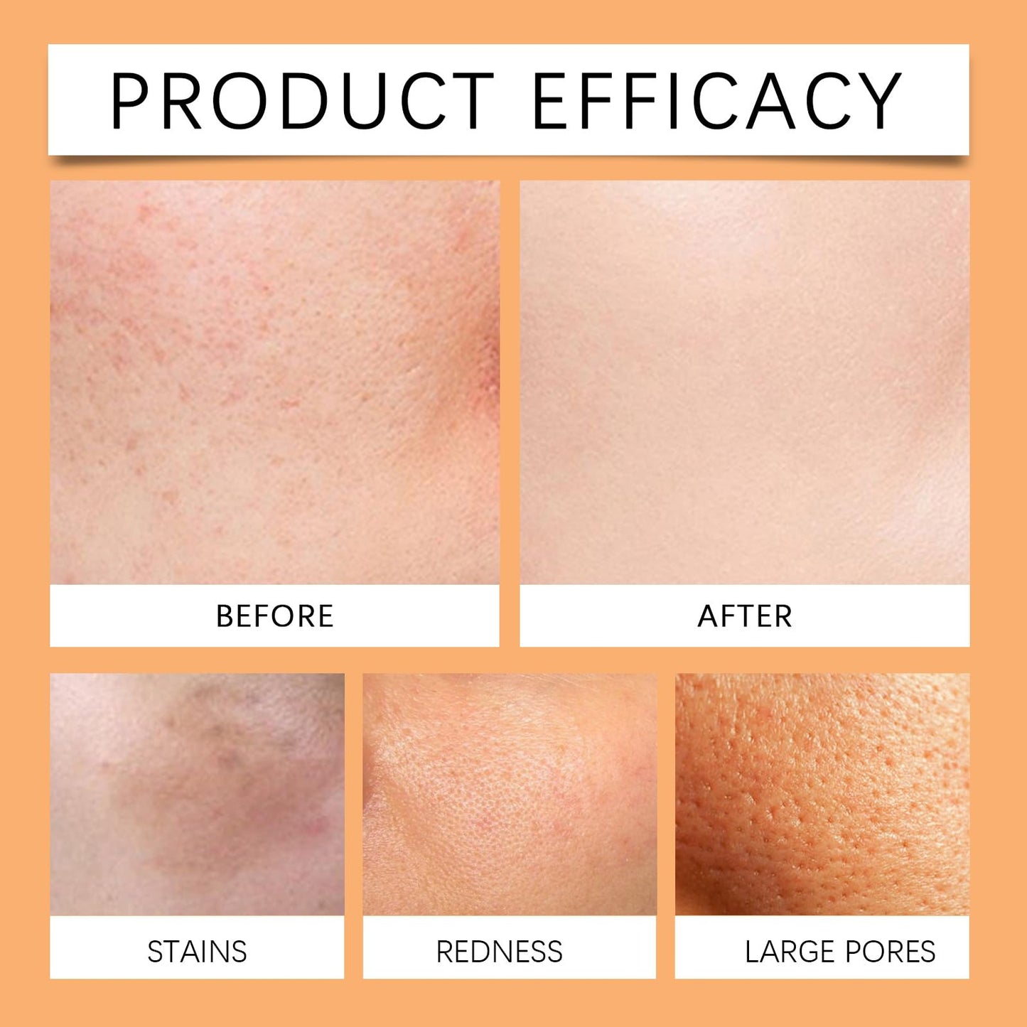 Vitamin C Gentle Face Scrub Exfoliating Face Wash for Blackheads, Pore Dirt & Dark Spots for All Skin Types - Softens & Smooths Skin with Vitamin C, Aloe Vera and Green Tea Extract