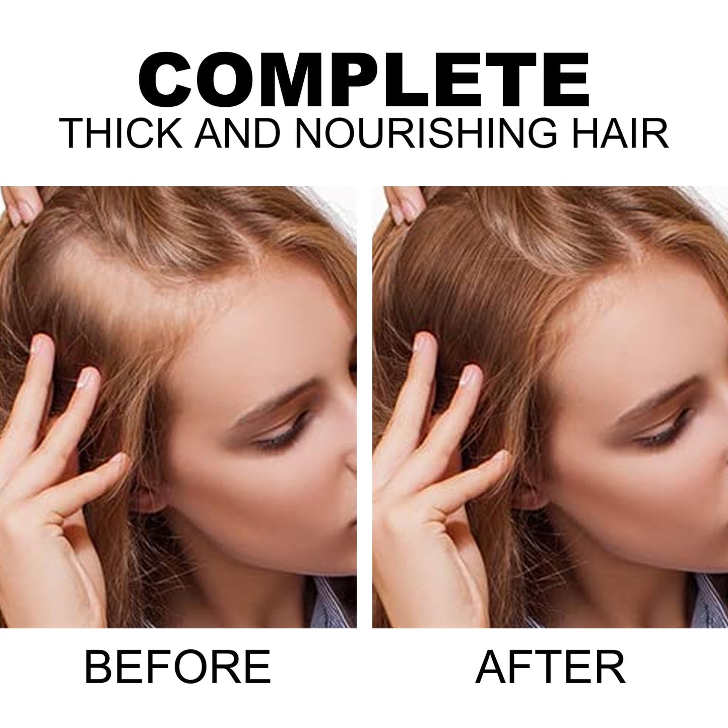 Hair Growth Spray, Black Rice Water for Hair Growth Serum - Leave-In Spray for Men & Women, Effective for Hair Loss, Damaged Dry Hair, Hair Regrowth for Thicker Longer Fuller Hair 3.38 fl oz