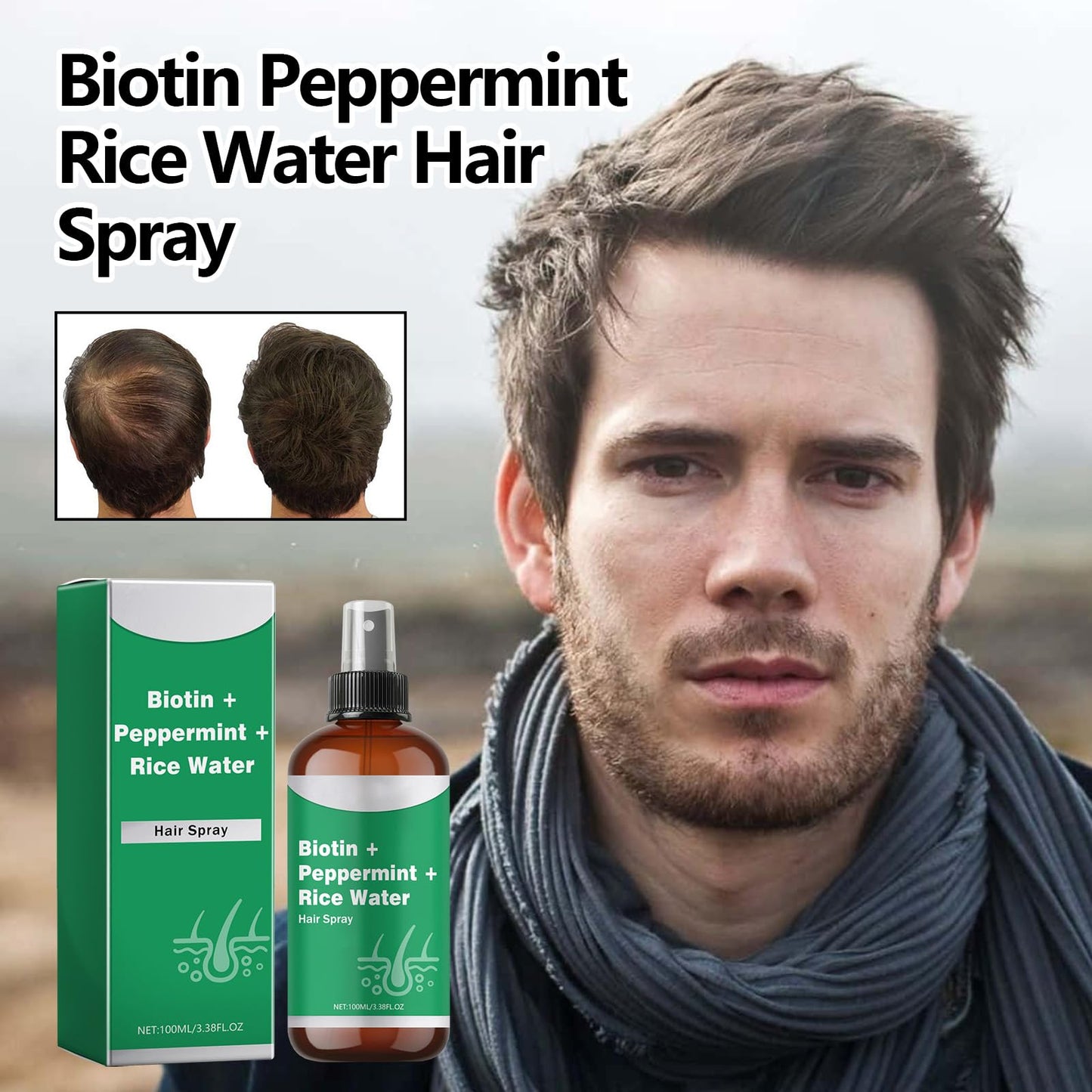 Rice Water for Hair Growth Spray - Serum with Biotin, Peppermint and Rice Water, Non-Greasy Spray Naturally Thicker, Longer, Softer Men & Women 3.38 fl oz