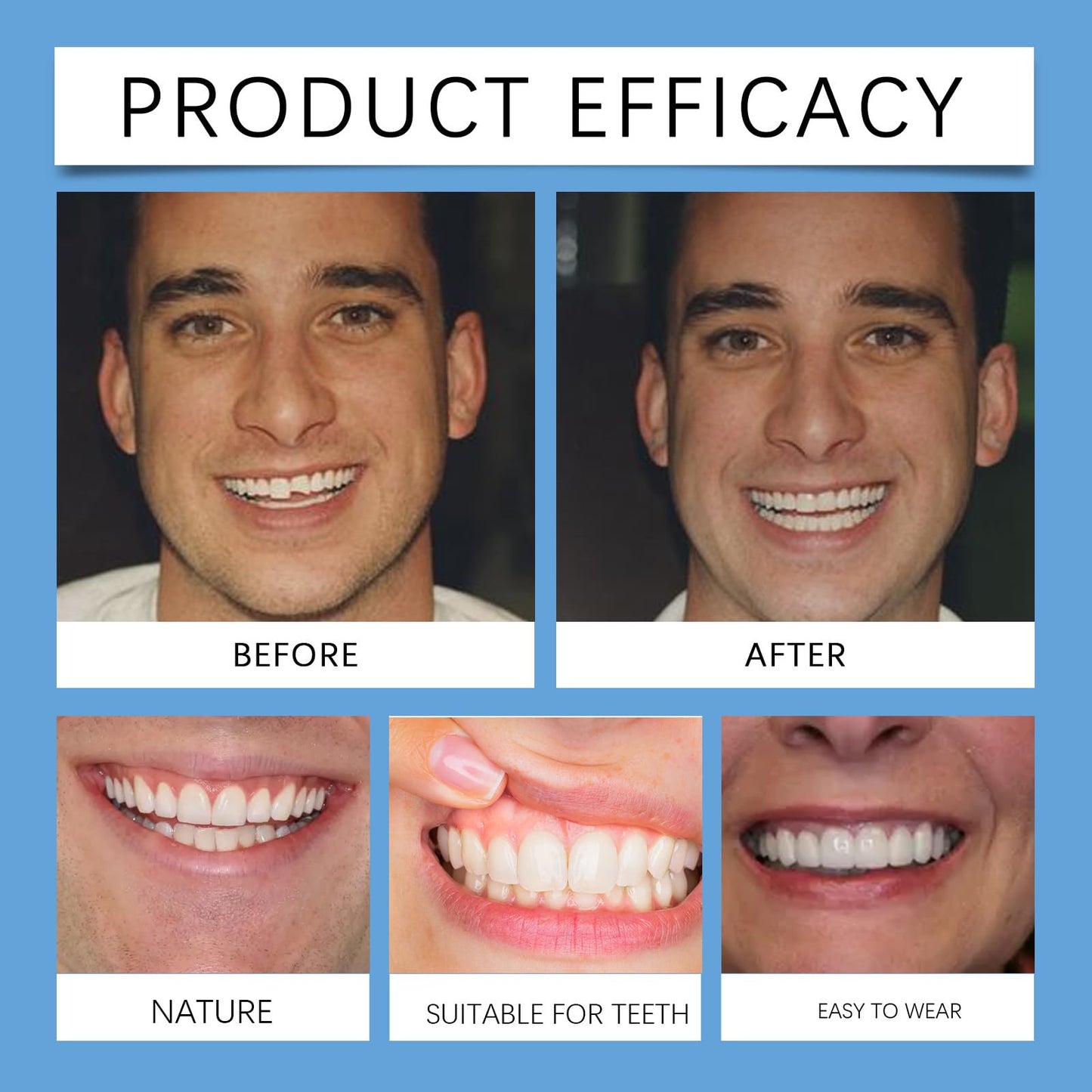 Silicone Denture Reline Kit for Men and Women Fake Teeth Natural Shade Soft Denture Reline Kit Make Teeth More Neat