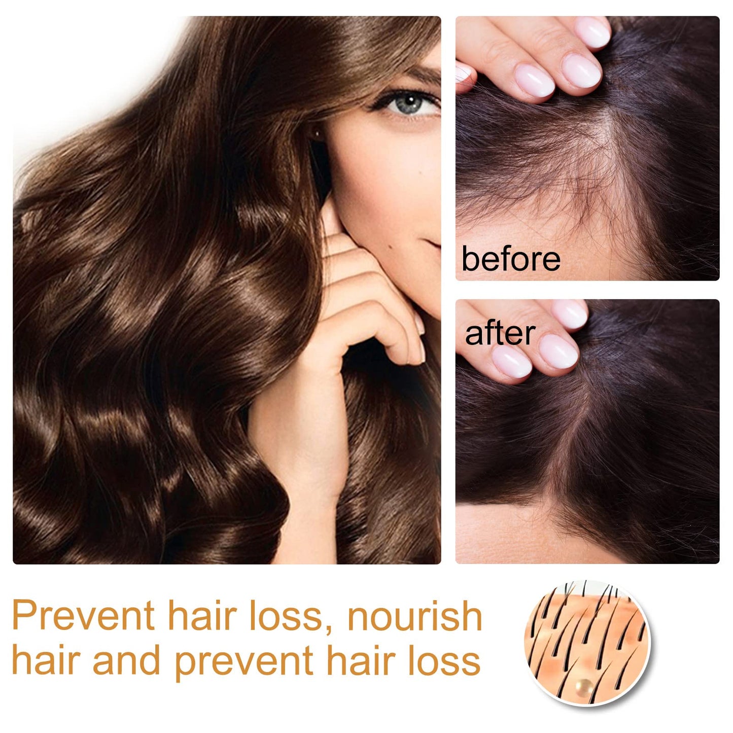 Rice Water Serum for Hair Growth Spray - Serum with Angelica Extract, Soybean, Wheat Germ for Hair Mask, Hair Care, Scalp Treatment, Thickening Dry Damaged Hair for Women & Men 1 fl oz