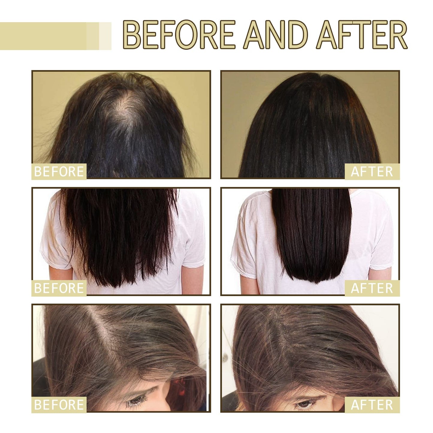 EELHOE Hair Growth Oil, Veganic Natural Hair Growth Oil, Veganic Rosemary Oil for Dry Damaged and Thin Hair, 2 Fl Oz