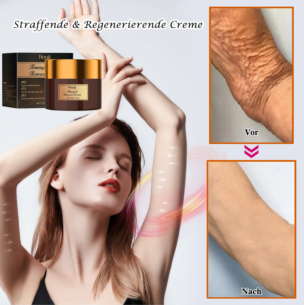 2024 Readers' Choice Award Winner๐HOYGI Firming & Renewal Cream: Restore Skin Elasticity