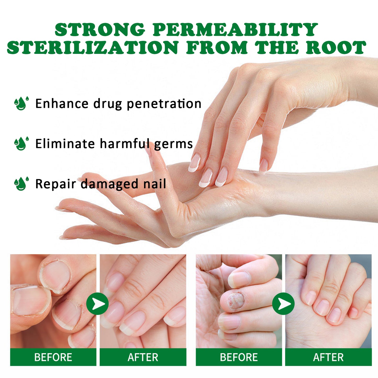 Jaysuing ginger nail care liquid repair hand and foot nail care soft nail bright nail moisturizing liquid onychomycosis