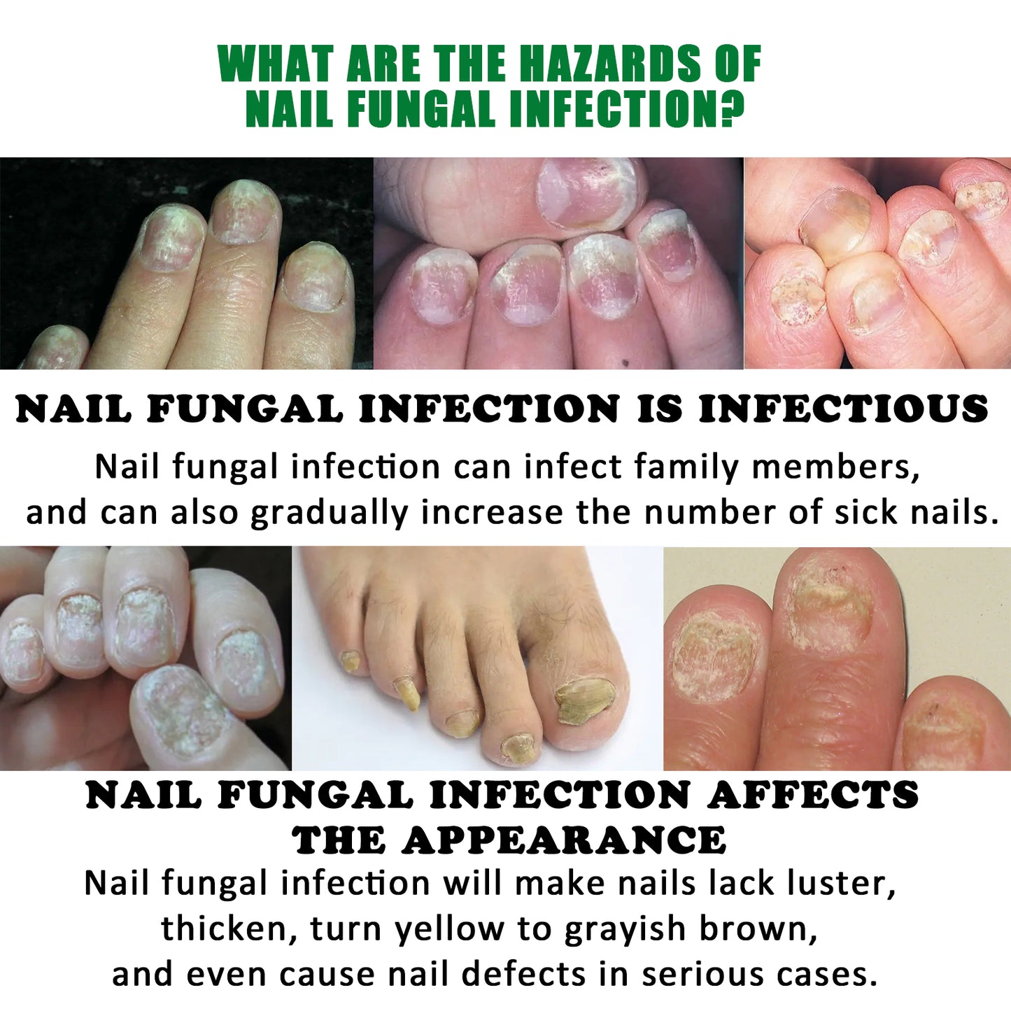 Jaysuing ginger nail care liquid repair hand and foot nail care soft nail bright nail moisturizing liquid onychomycosis
