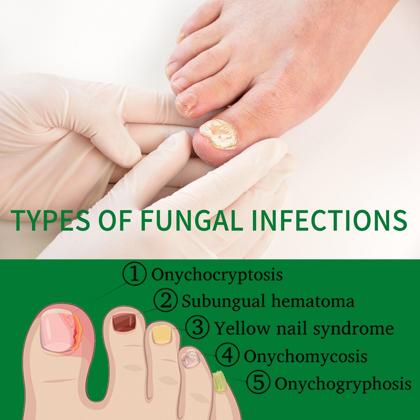 Jaysuing ginger nail care liquid repair hand and foot nail care soft nail bright nail moisturizing liquid onychomycosis