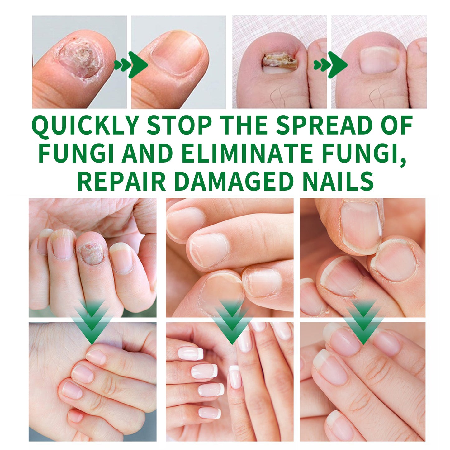 Jaysuing ginger nail care liquid repair hand and foot nail care soft nail bright nail moisturizing liquid onychomycosis