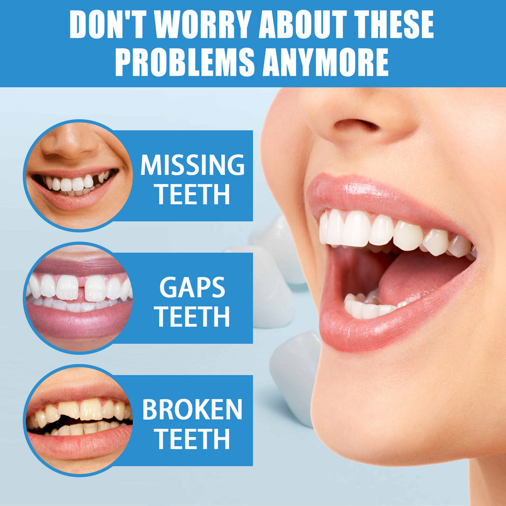 Professional Teeth Repair Kit - Instant Temporary Fix for Missing, Broken-30g