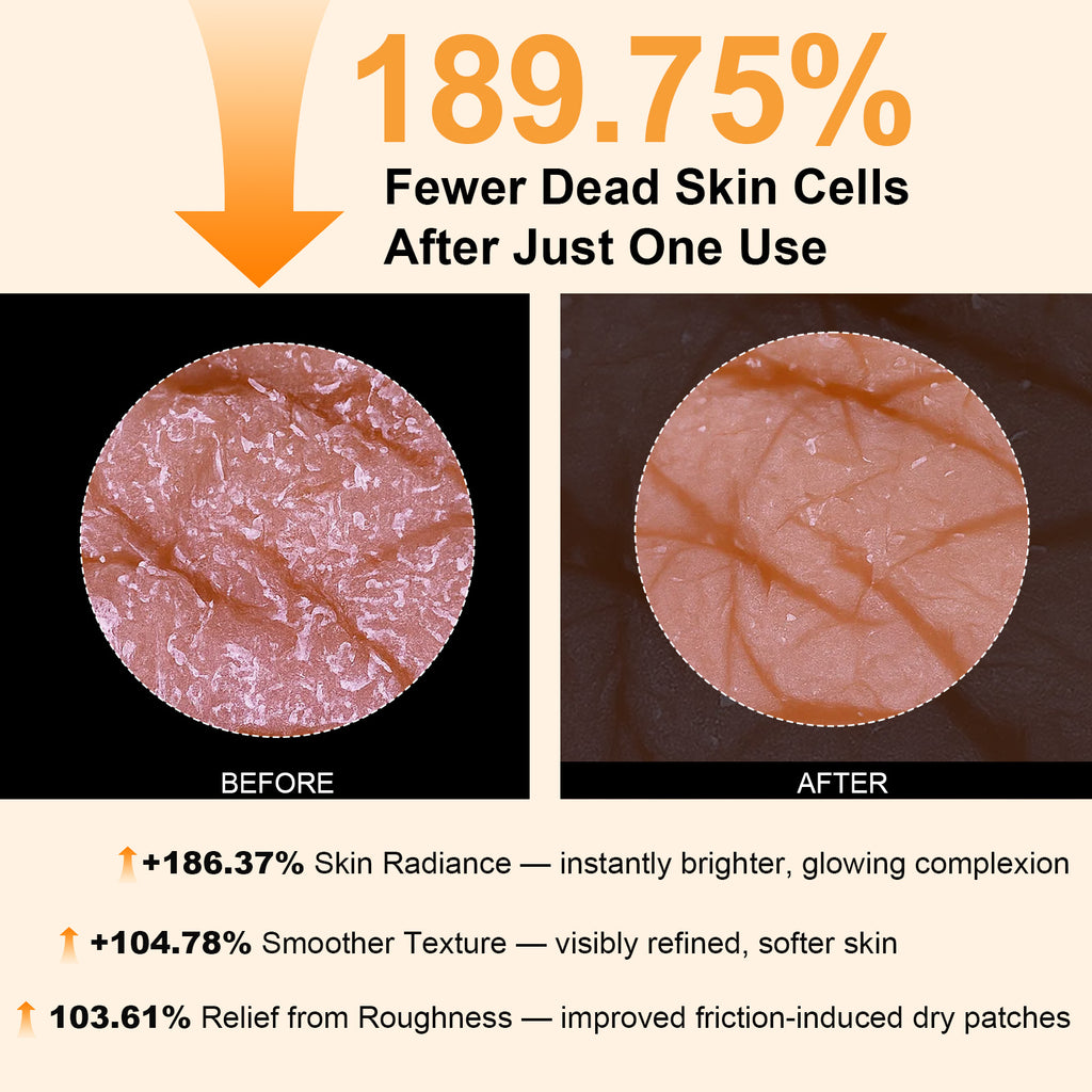 CAMRESIC Exfoliating Body Spray with Kojic Acid & Turmeric-100ml