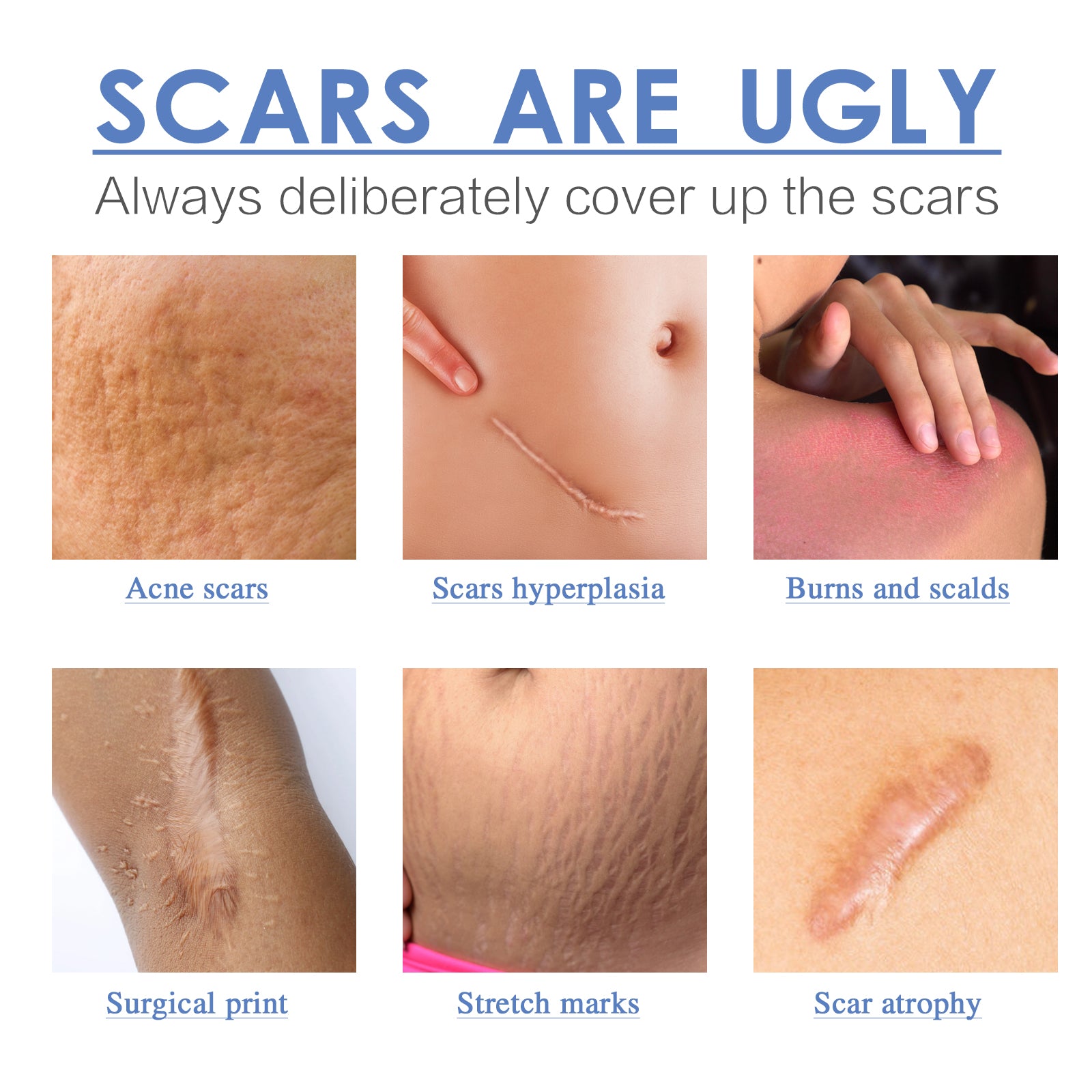 MediPatch Silicone Scar Sheets – Doctor-Tested, Invisible Healing for Surgery, Acne & Burn Scars