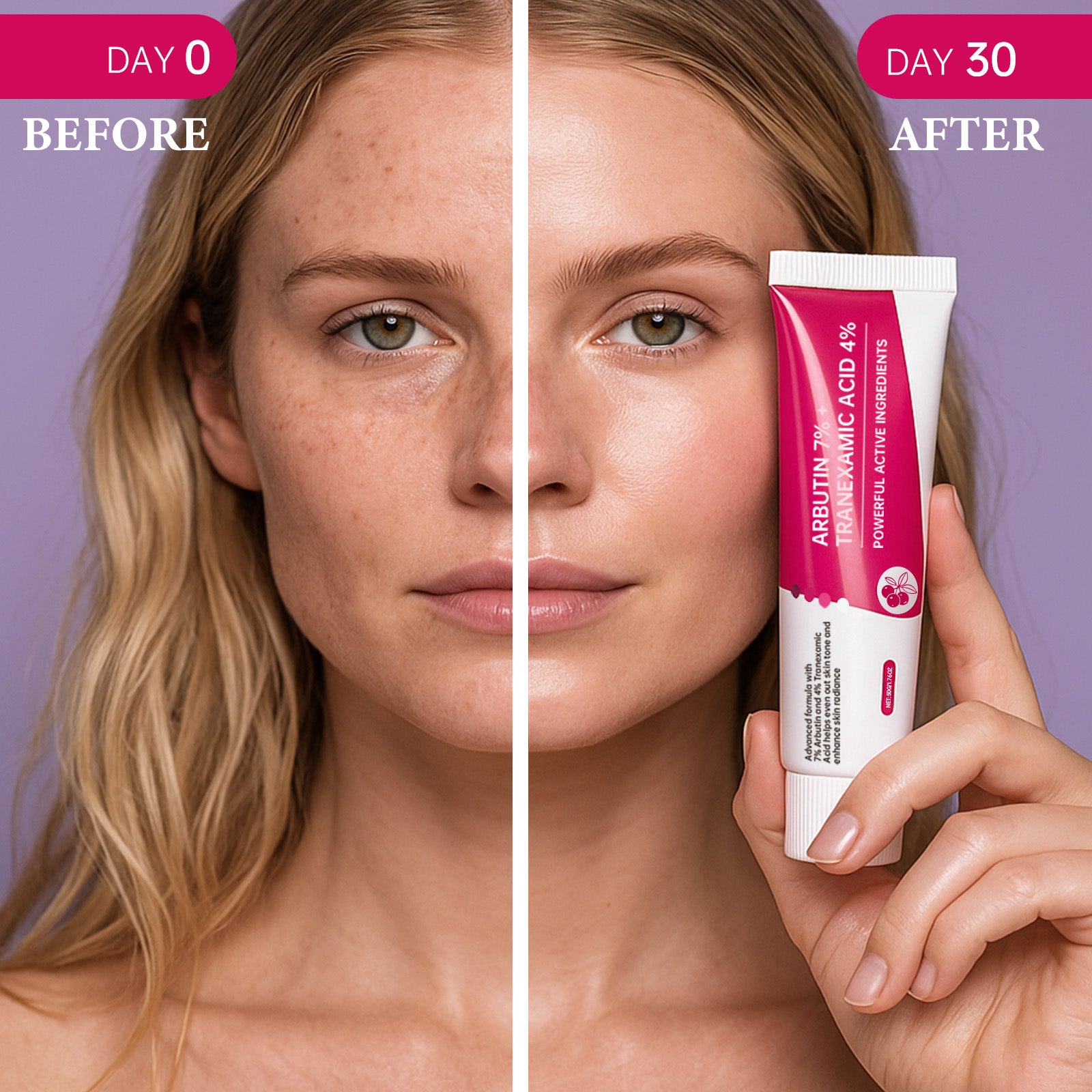 ROSEBLEM Brightening Treatment with 7% Arbutin & 4% Tranexamic Acid-50g