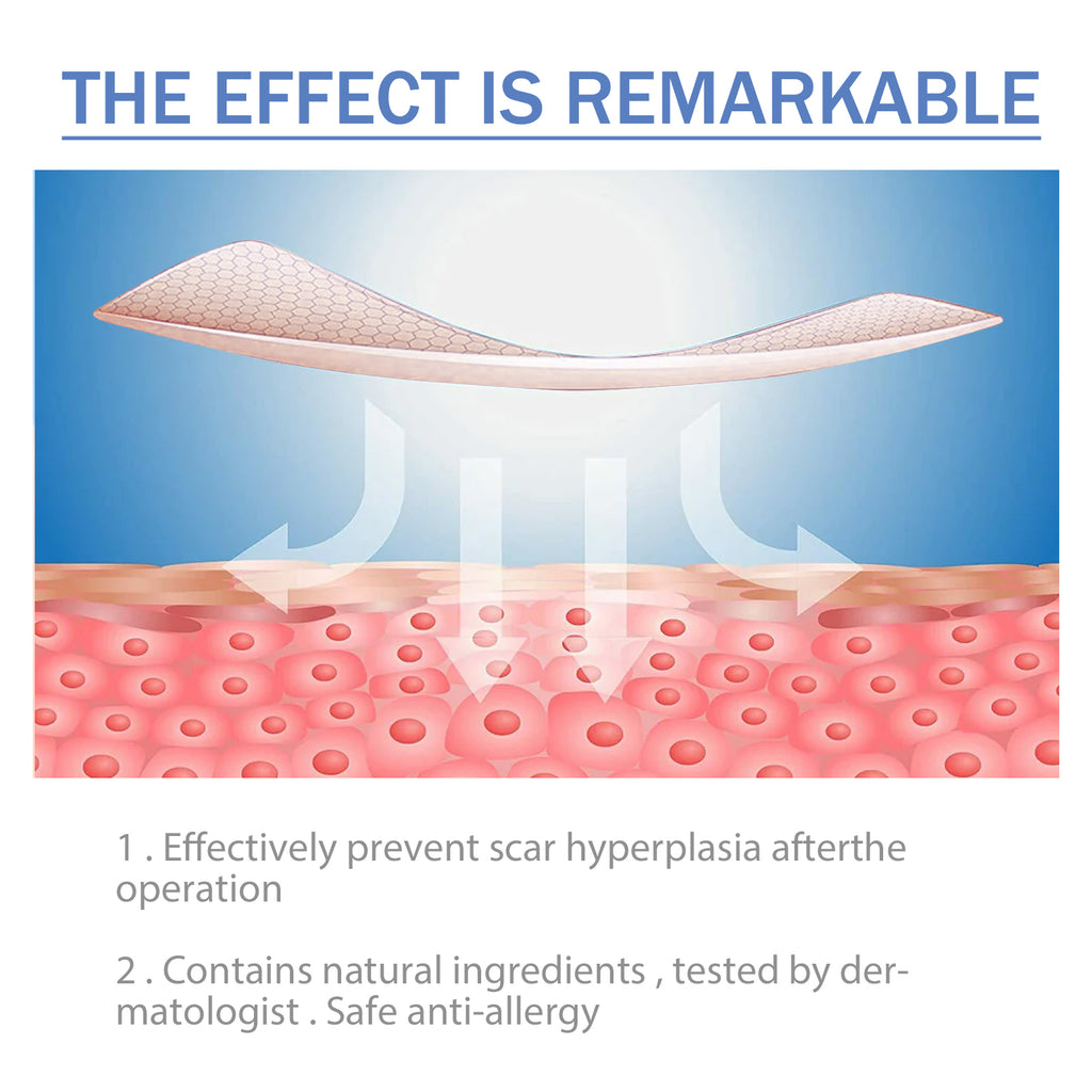 MediPatch Silicone Scar Sheets – Doctor-Tested, Invisible Healing for Surgery, Acne & Burn Scars