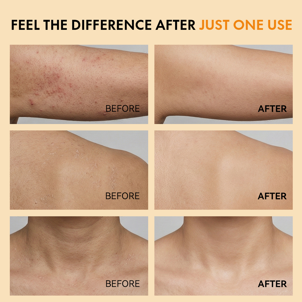 CAMRESIC Exfoliating Body Spray with Kojic Acid & Turmeric-100ml