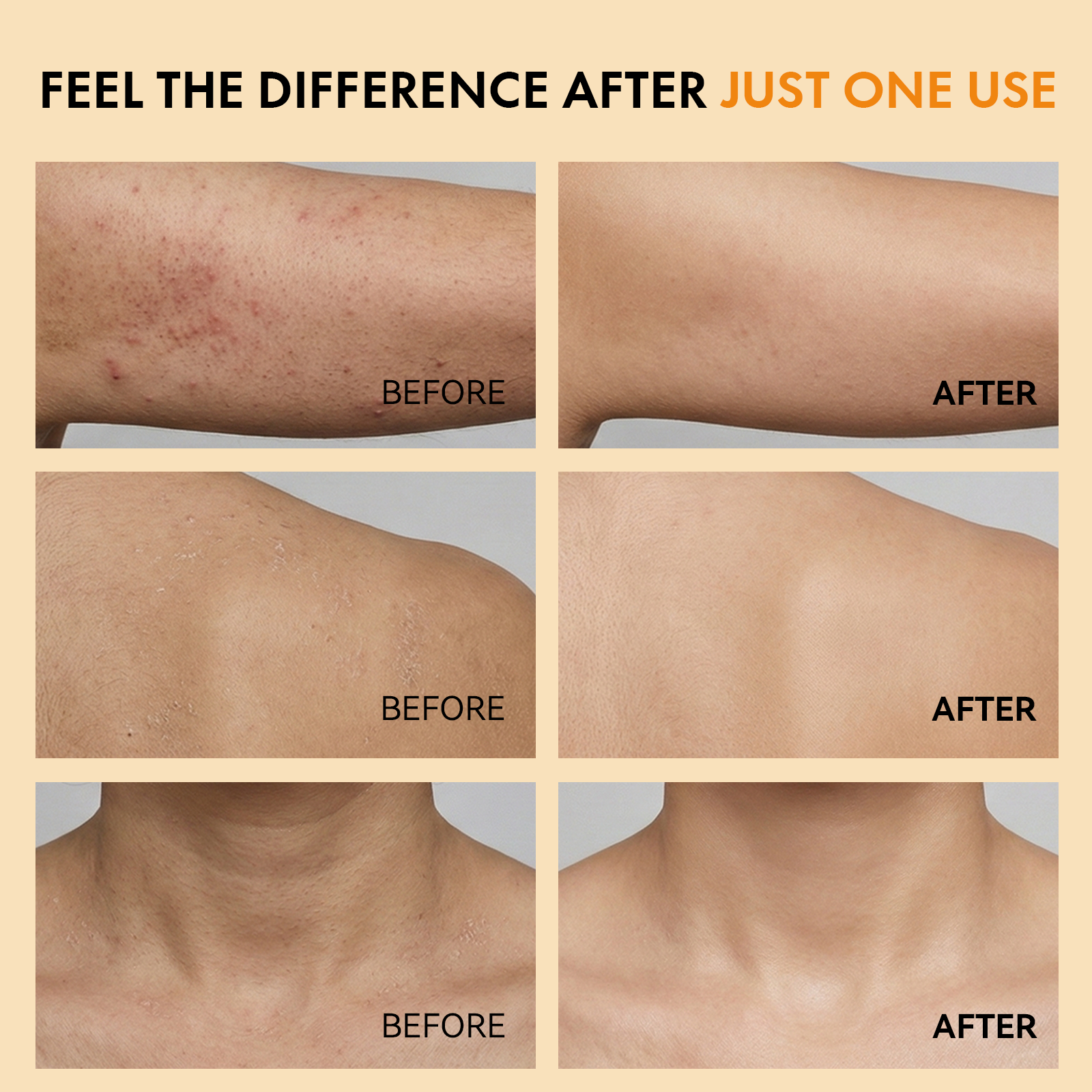 CAMRESIC Exfoliating Body Spray with Kojic Acid & Turmeric-100ml