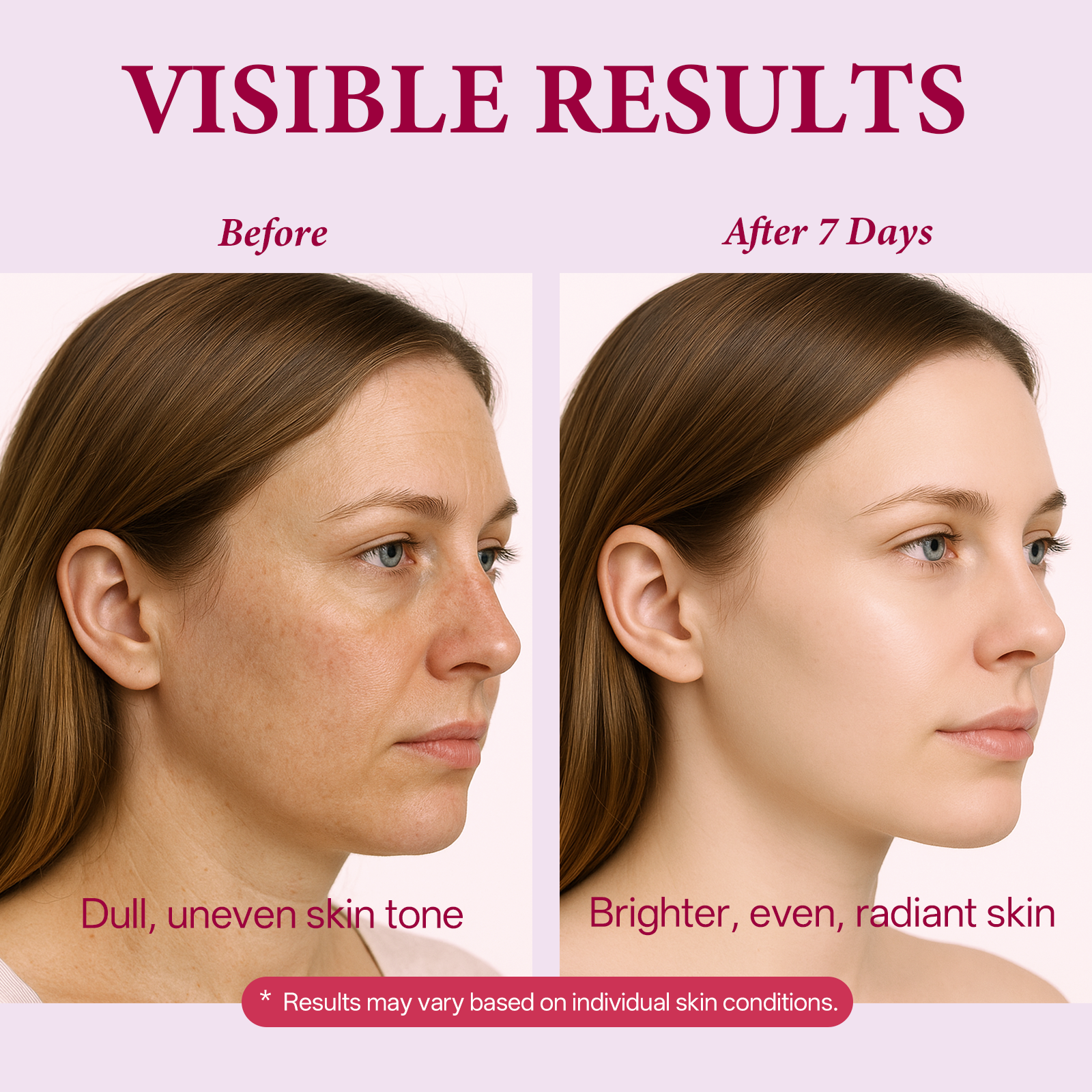ROSEBLEM Brightening Treatment with 7% Arbutin & 4% Tranexamic Acid-50g