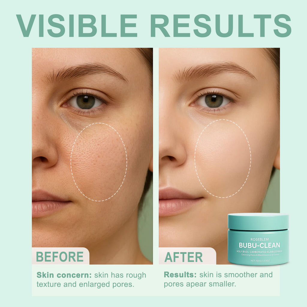 ROSEBLEM™-HOLY BASIL CARBONATED BUBBLED MASK 100g