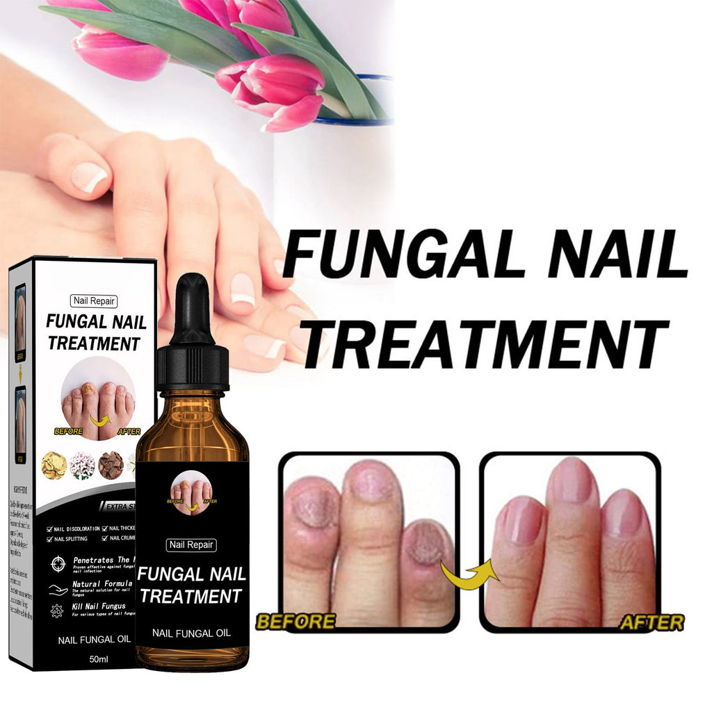 Arishine PENCIL BRIGHT: Doctor-Recommended Natural Nail Fungus Treatment with 5% Acetic Acid & Botanicals-30ml