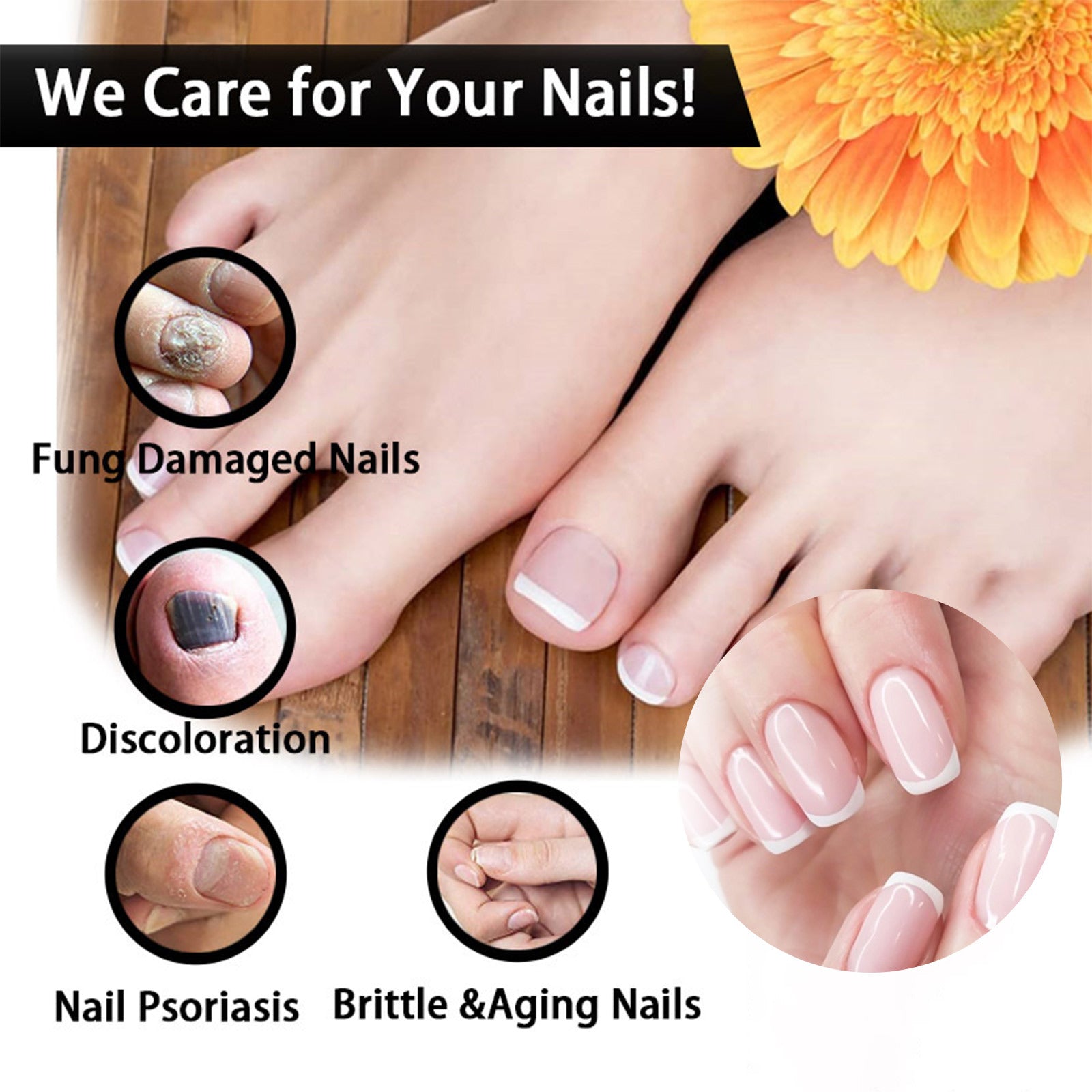 Arishine PENCIL BRIGHT: Doctor-Recommended Natural Nail Fungus Treatment with 5% Acetic Acid & Botanicals-30ml